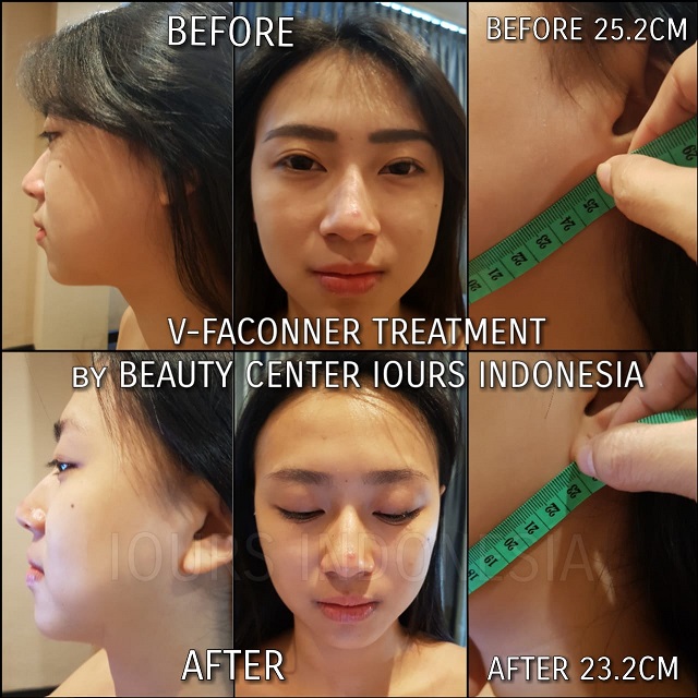 Beauty Treatment